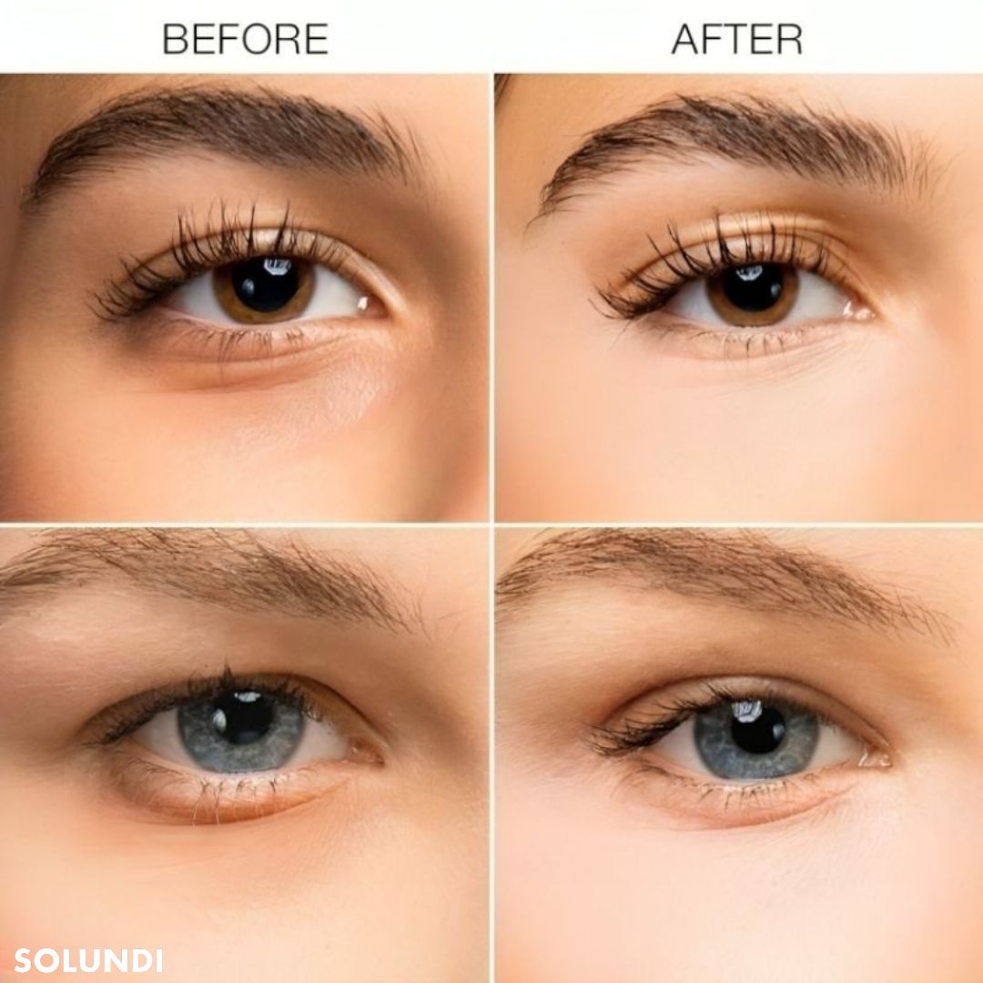 1 + 1 GRATIS VANDAAG | GlowGaze⢠| Donkere kringen verhelderaar