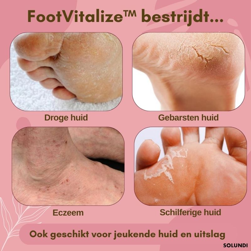 1+1 GRATIS TIJDELIJK | FootVitalize™ - Voetherstellende crème