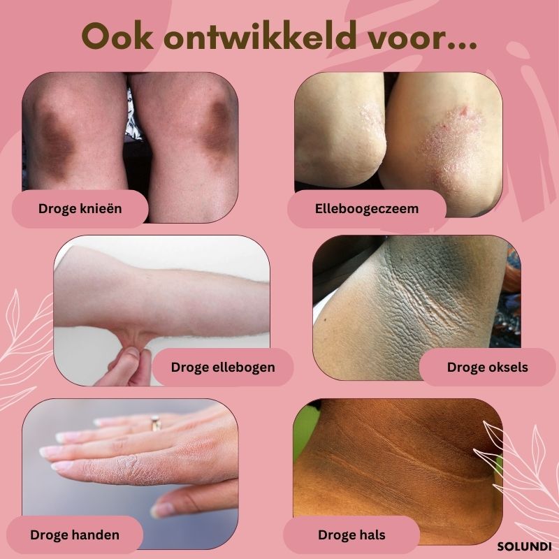 1+1 GRATIS TIJDELIJK | FootVitalize™ - Voetherstellende crème