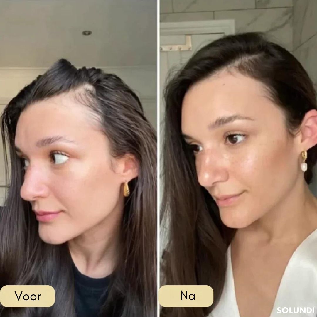 VitalGrow™ NEW EDITION | Jouw natuurlijke oliebehandeling voor haargroei