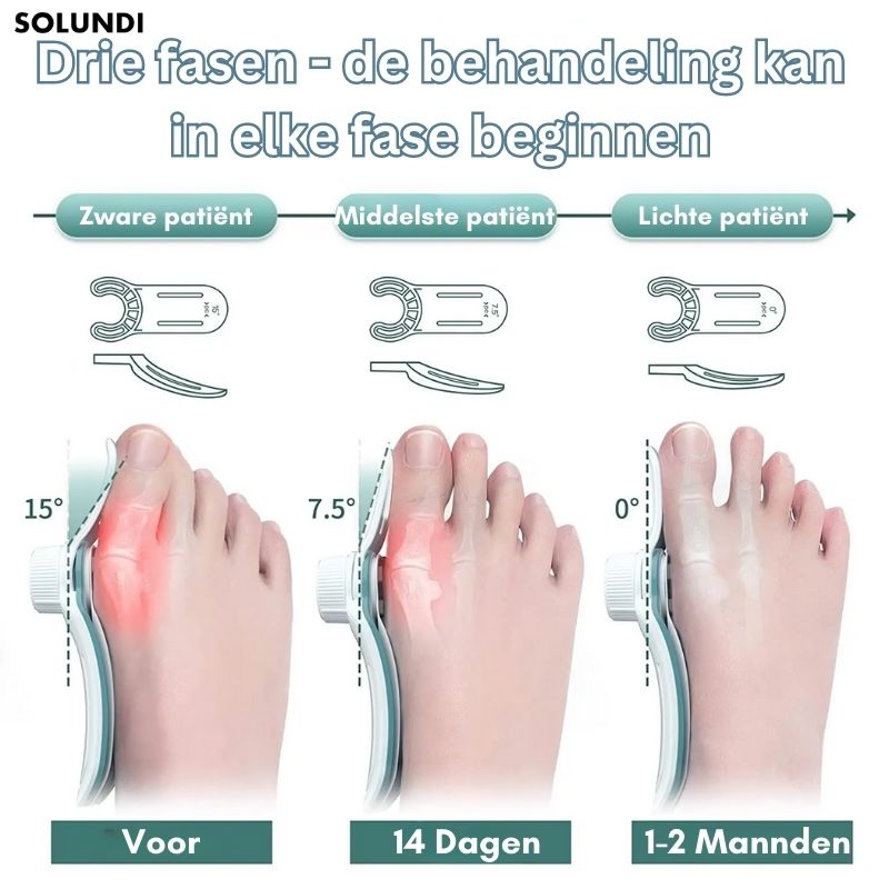 1 + 1 GRATIS VANDAAG | OrthoAlign⢠â Grote teen Corrector