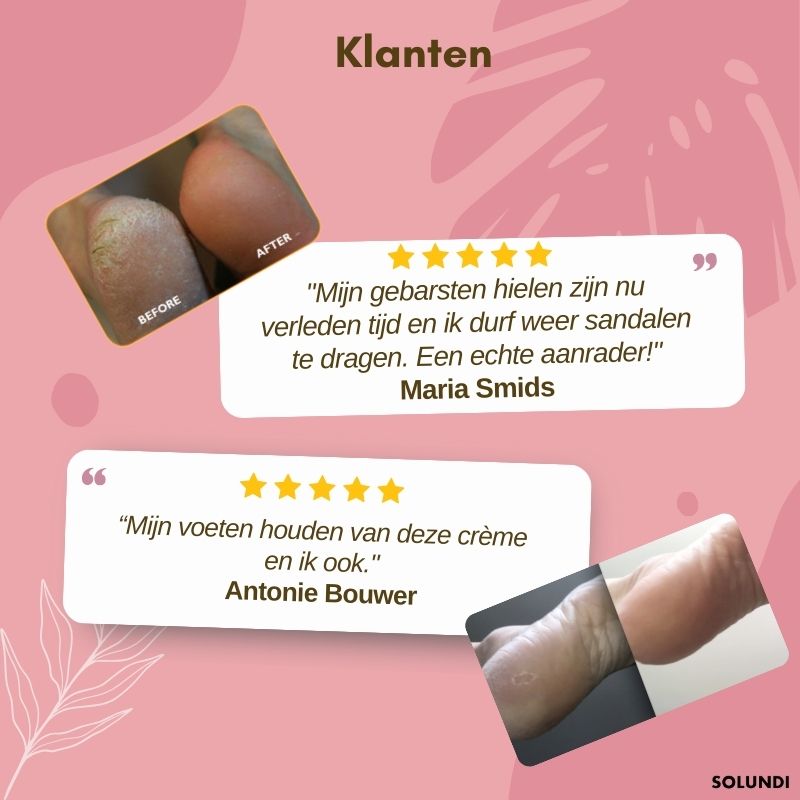 1+1 GRATIS TIJDELIJK | FootVitalize™ - Voetherstellende crème