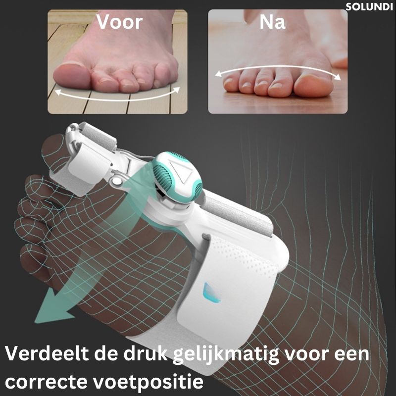 1 + 1 GRATIS VANDAAG | OrthoAlign⢠â Grote teen Corrector