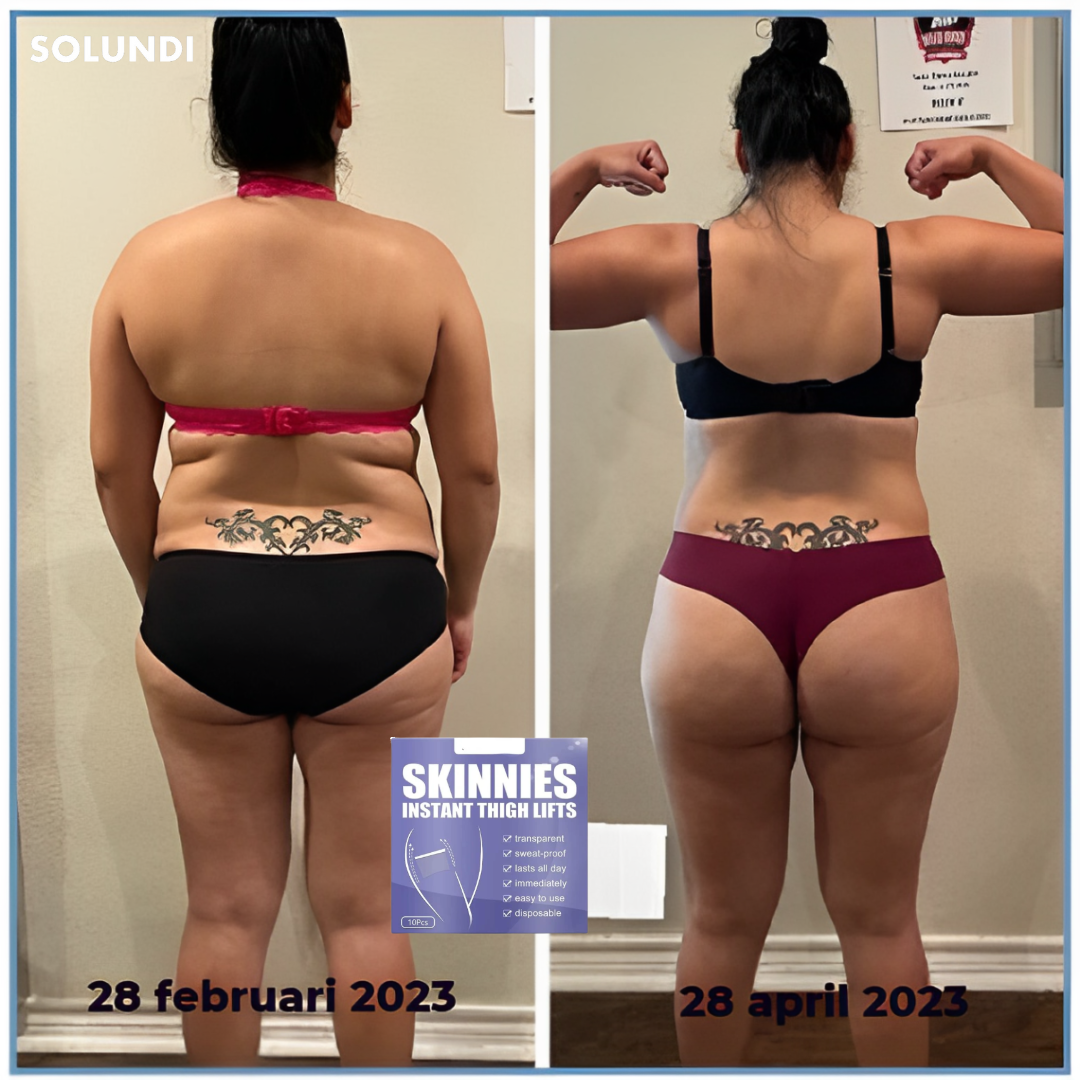 1 + 2 GRATIS VANDAAG | InvisiTight™ | De onzichtbare collageen patches voor een stevigere huid!