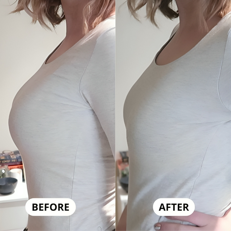 SlimFit™ | Een beha die je borsten zachtjes minimaliseert!
