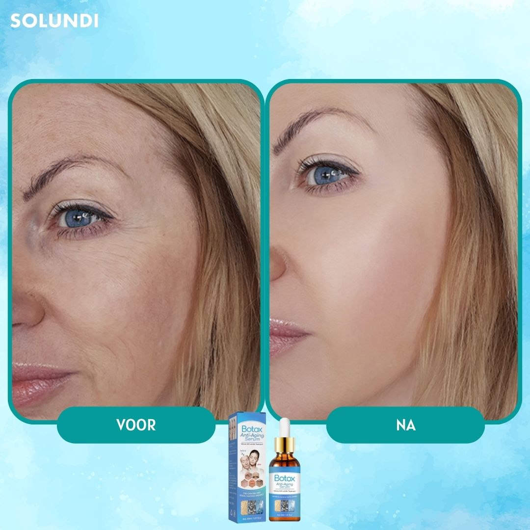 1 + 1 GRATIS VANDAAG | YouthGlow™ - Botox Anti-aging Serum