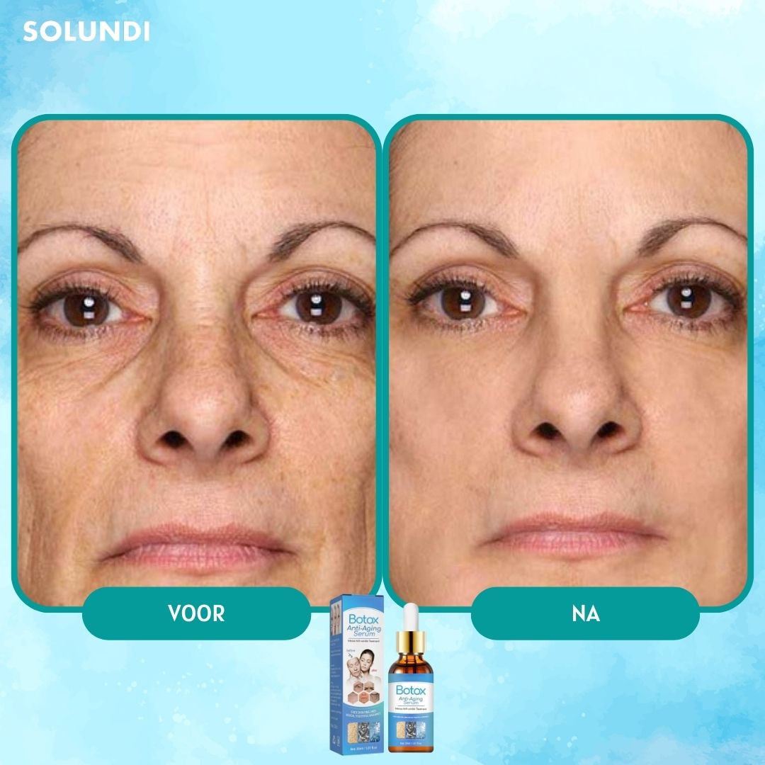 1 + 1 GRATIS VANDAAG | YouthGlow™ - Botox Anti-aging Serum