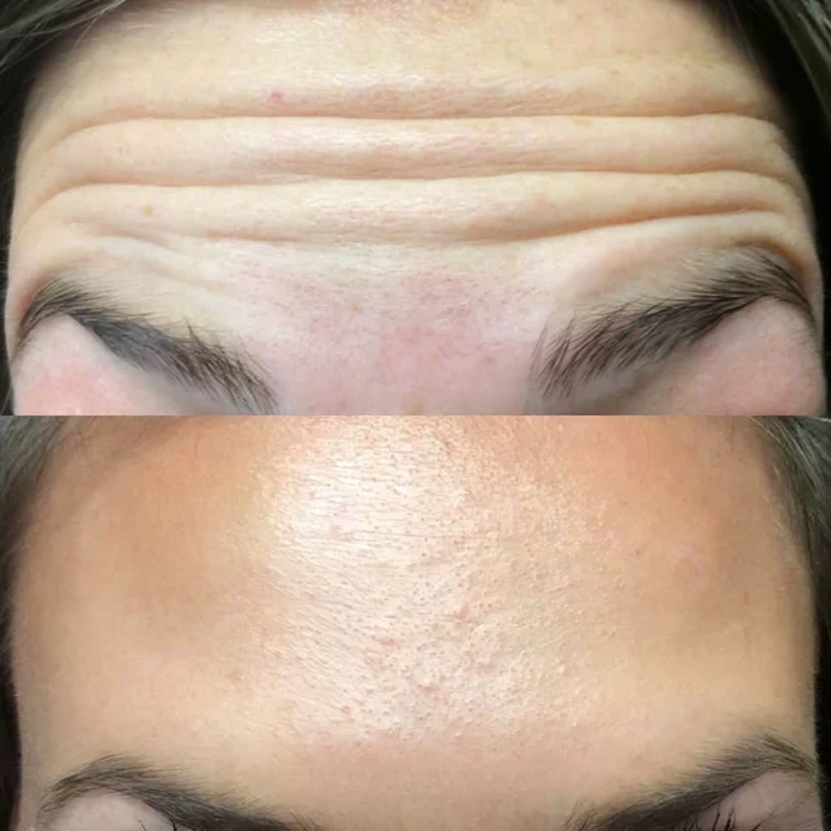 TIJDELIJK 50% KORTING | GlowLift™ | Het geheim van tijdloze schoonheid!