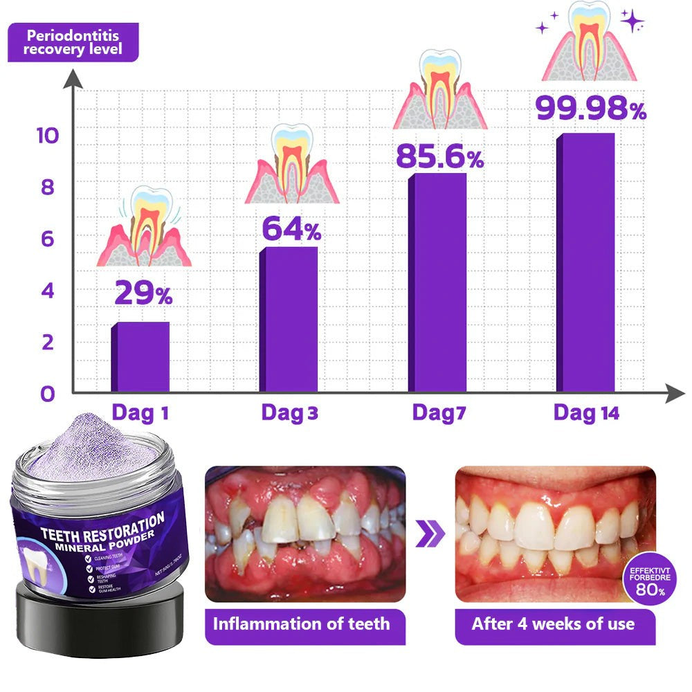 TIJDELIJK 50% KORTING | DentiGlow™
