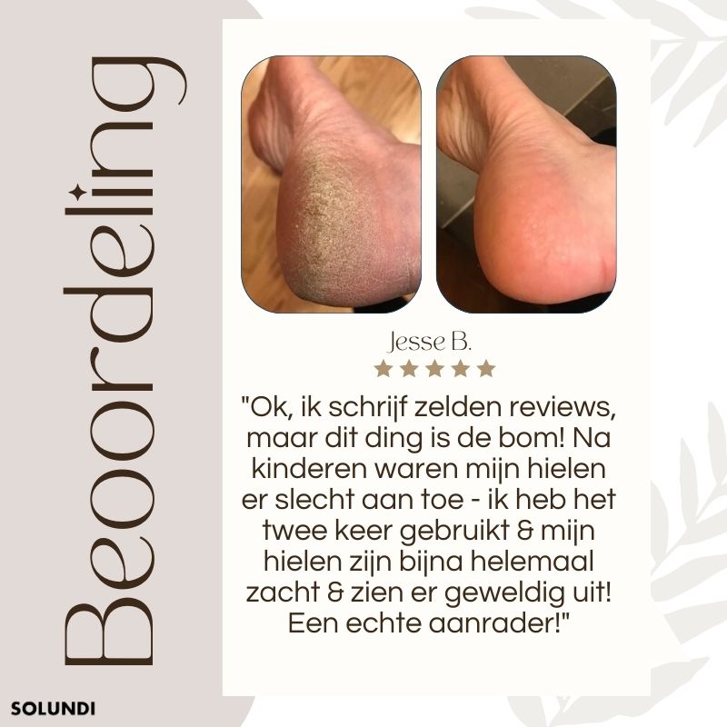 CallusMaster⢠- Elektrische eelttovenaar | 50% tijdelijke korting