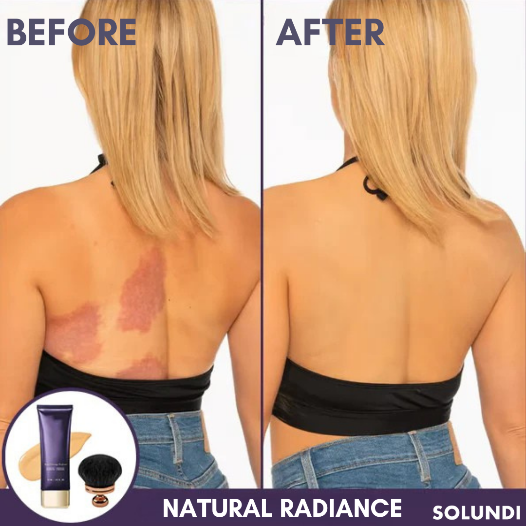 TIJDELIJK 50% KORTING | CoverAll™ | Verberg je huidoneffenheden onmiddellijk!