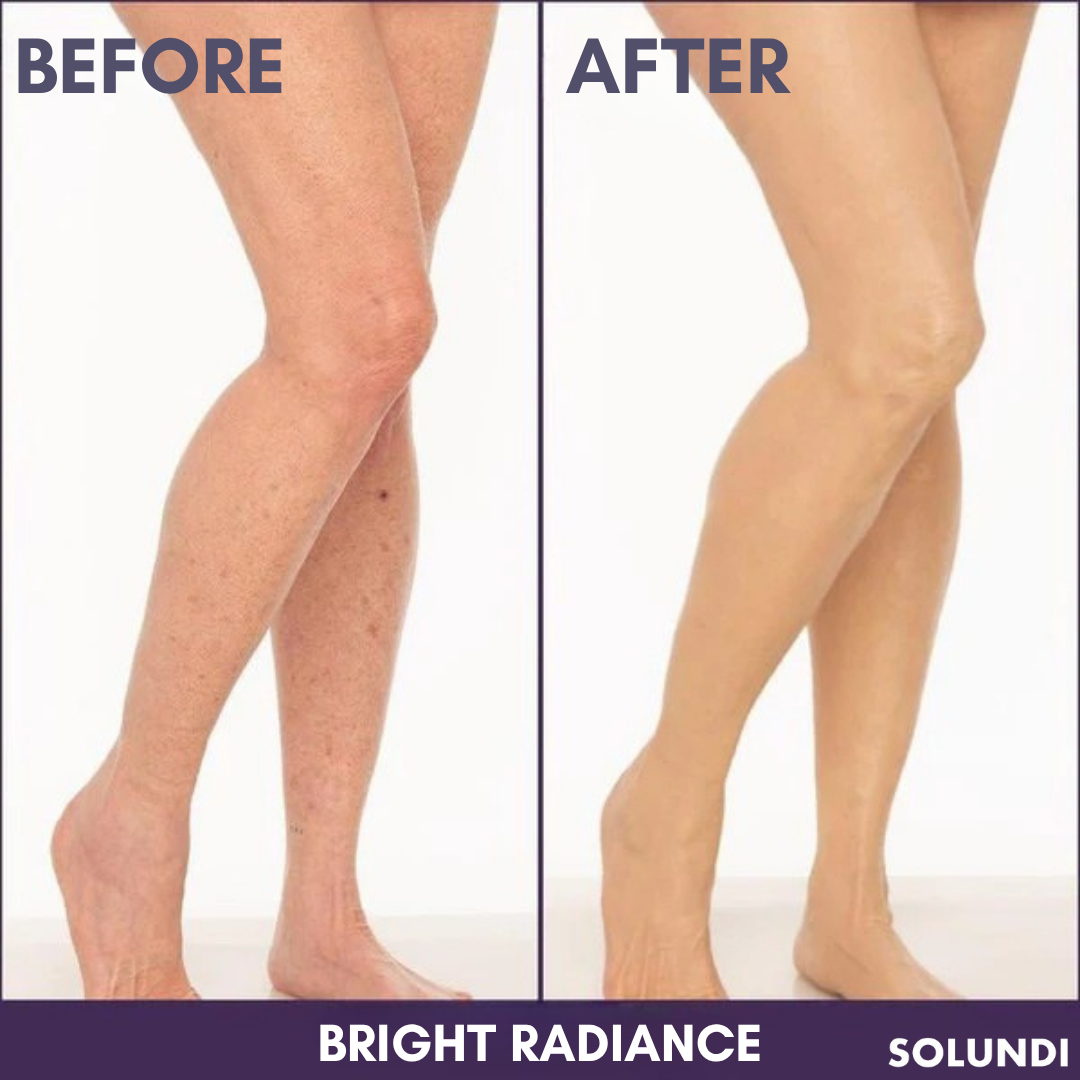 TIJDELIJK 50% KORTING | CoverAll™ | Verberg je huidoneffenheden onmiddellijk!