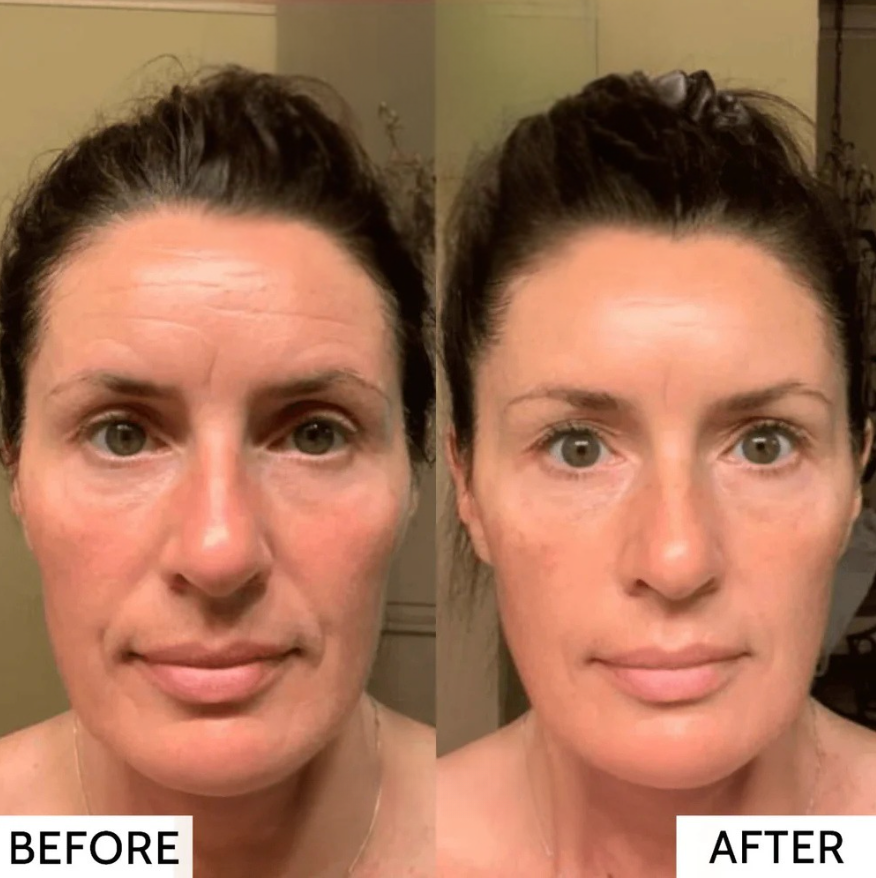 RevitaMask⢠| Huid collageen masker