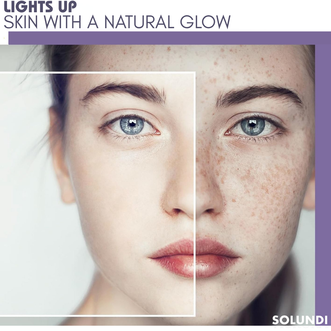 TIJDELIJK 50% KORTING | CoverAll™ | Verberg je huidoneffenheden onmiddellijk!