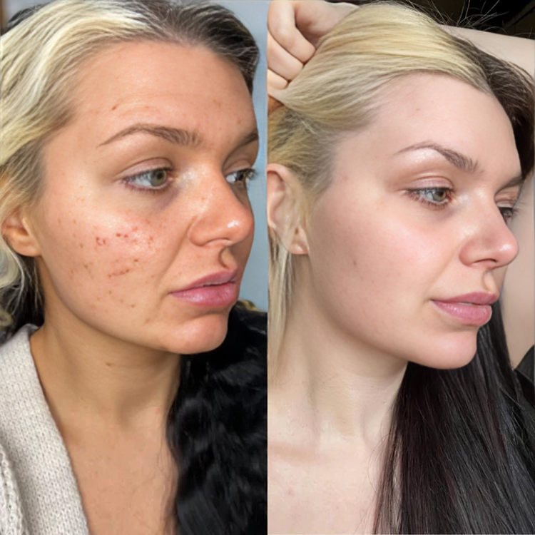 TIJDELIJK 50% KORTING | GlowLift™ | Het geheim van tijdloze schoonheid!