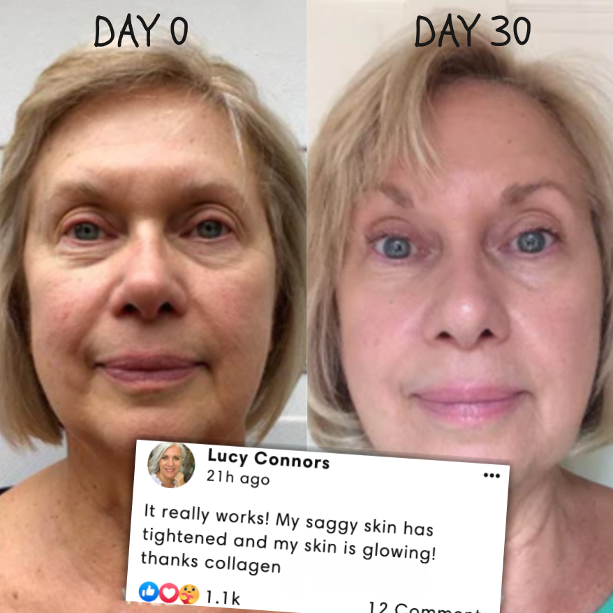 RevitaMask⢠| Huid collageen masker