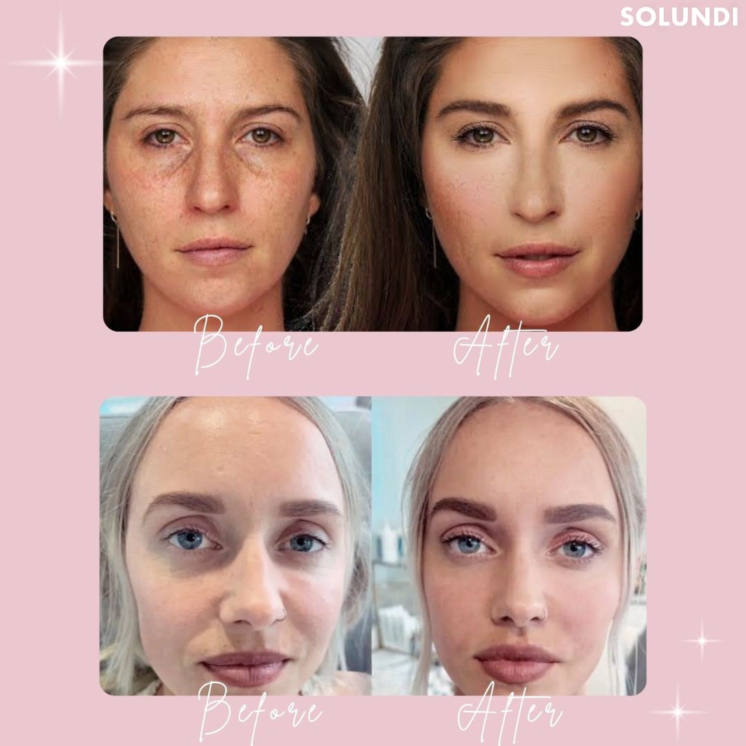 1 + 1 GRATIS VANDAAG | GlowGaze⢠| Donkere kringen verhelderaar