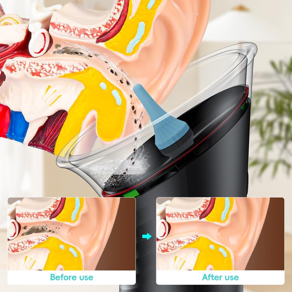 TIJDELIJK 50% KORTING | EarJet™