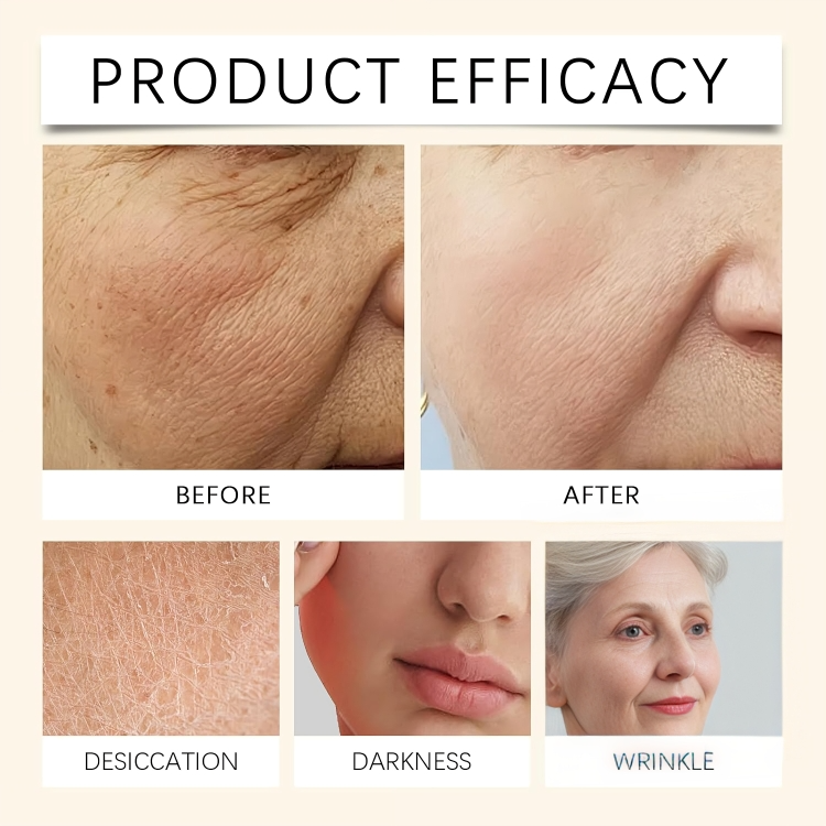 TIJDELIJK 50% KORTING | NouriSkin⢠| Onthul het geheim van een zijdezachte huid van top tot teen!