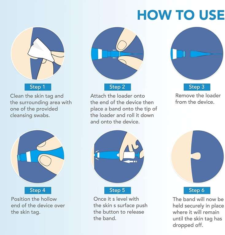 TagErase⢠| Verwijder skin tags snel en veilig!