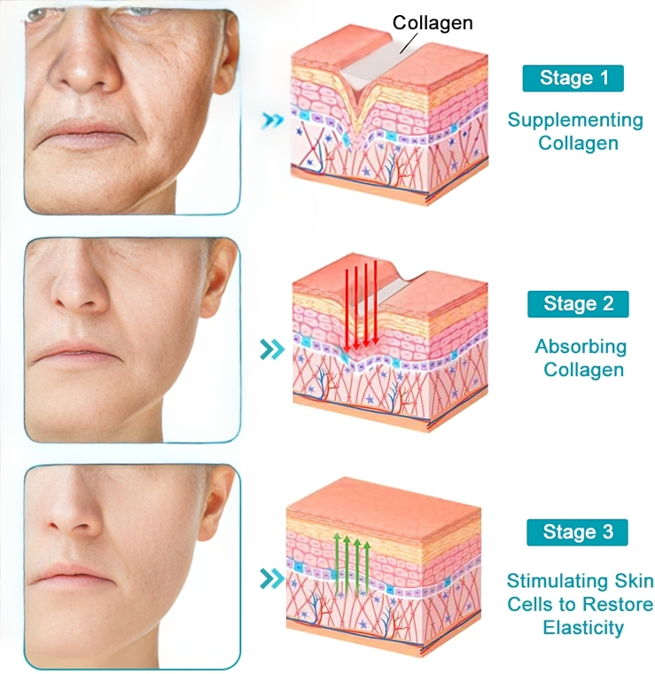 RevitaStick⢠| Jouw geheim voor een stevigere, elastischere huid!