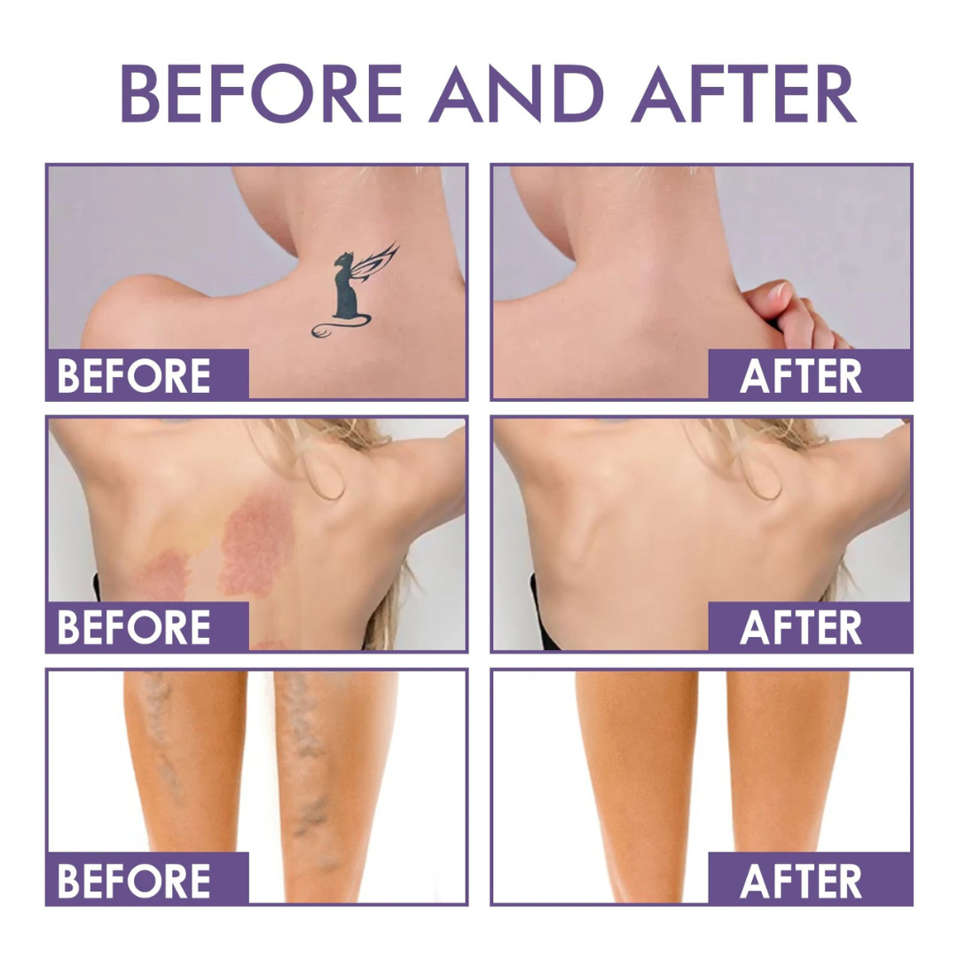 TIJDELIJK 50% KORTING | DermaVelle⢠| Een vlekkeloze huid in seconden - zonder filters!