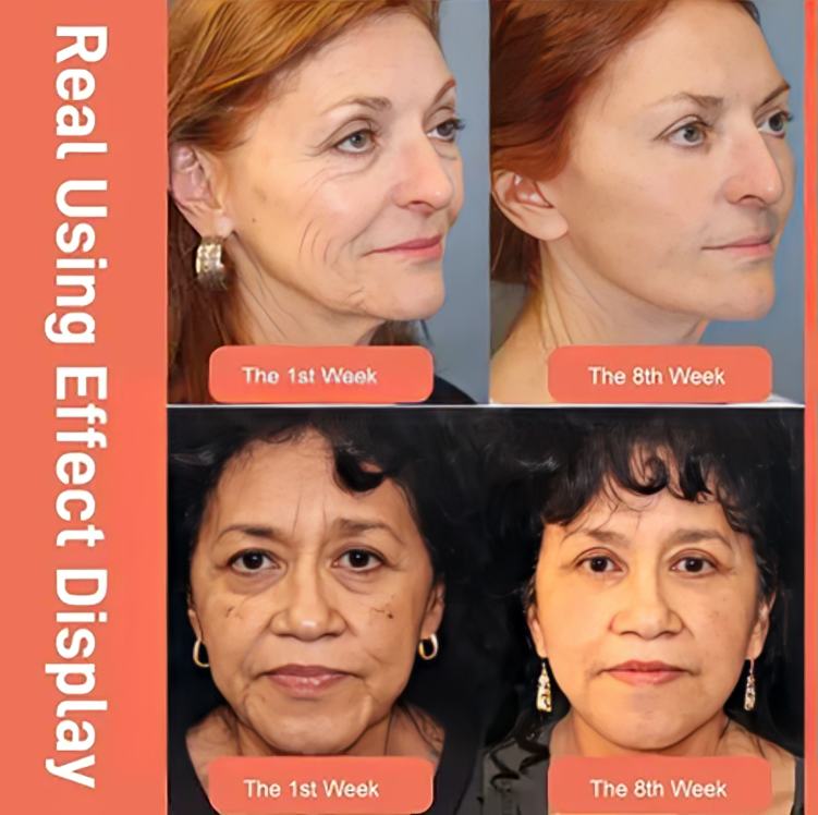 1 + 1 GRATIS VANDAAG | FirmGlow™ | Retinol Drakenbloed Anti-Rimpel Crème