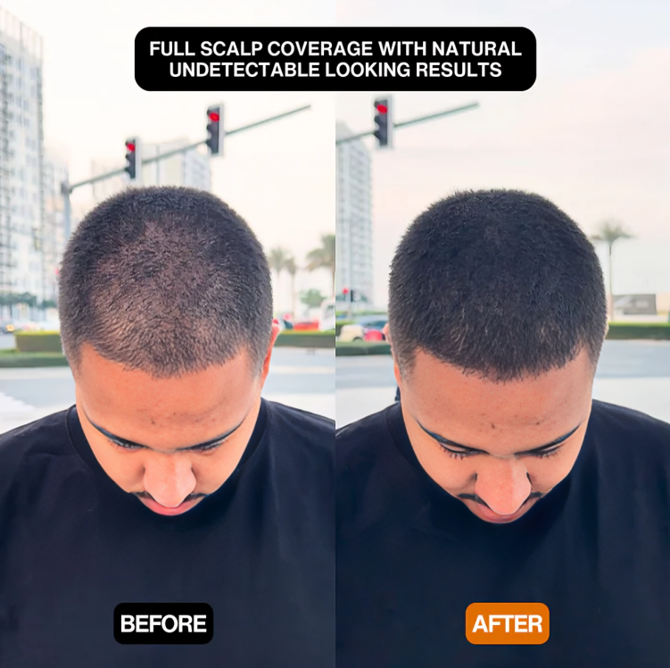 1 + 1 GRATIS VANDAAG | CoverEdge⢠| Een snelle oplossing voor een natuurlijke, volumineuze haarlijn!