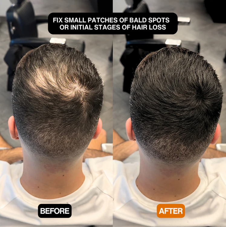 1 + 1 GRATIS VANDAAG | CoverEdge⢠| Een snelle oplossing voor een natuurlijke, volumineuze haarlijn!