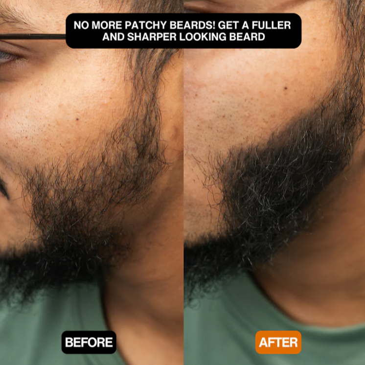 1 + 1 GRATIS VANDAAG | CoverEdge⢠| Een snelle oplossing voor een natuurlijke, volumineuze haarlijn!