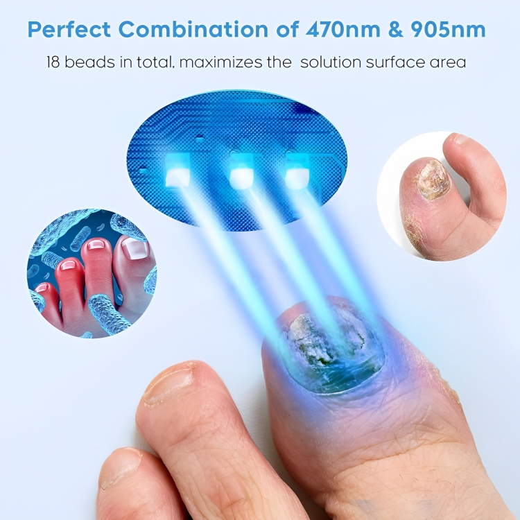 NailRenew™ | Bestrijd en elimineer schimmelnagels!