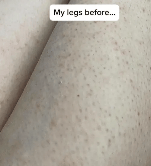 1 + 1 GRATIS VANDAAG DermaBareā¢