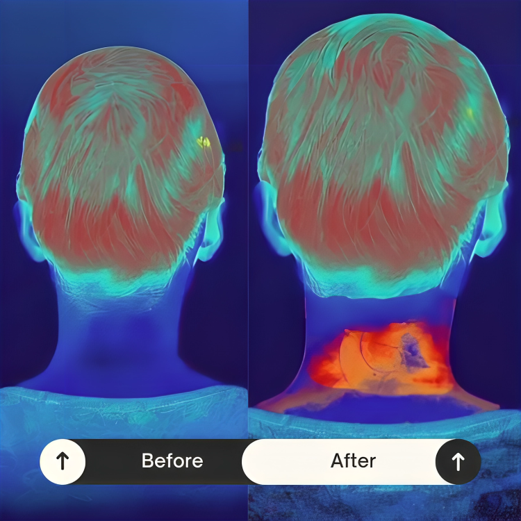 NeckEase⢠| Maak in een paar minuten een einde aan nekpijn!