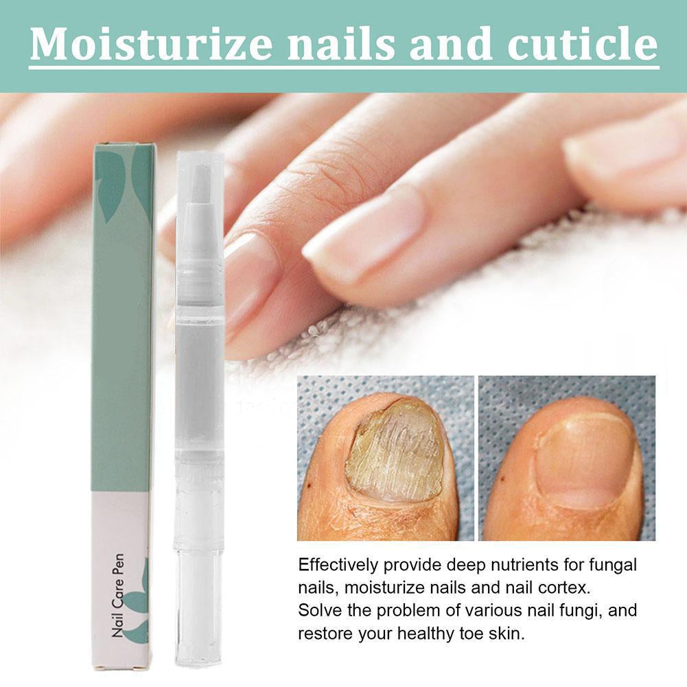 NailEssence⢠| Organische nagelverzorgingspen