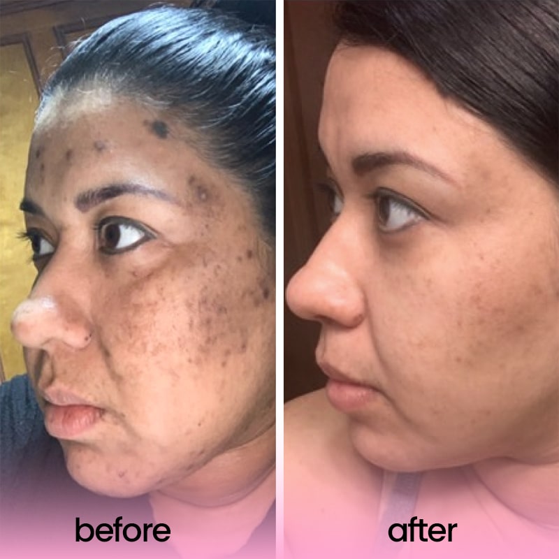 GlowZest™ | Een stralende huid in slechts één gebruik!