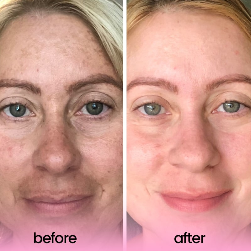 GlowZest™ | Een stralende huid in slechts één gebruik!