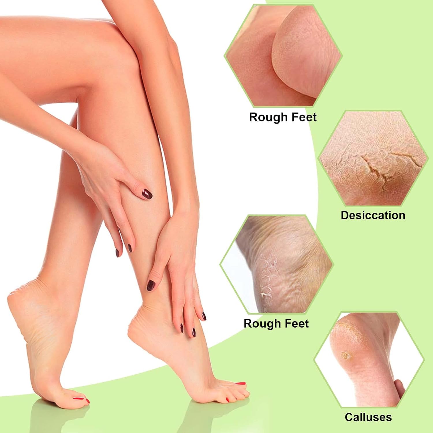 HydraFeet™ | Zeg maar dag tegen gebarsten hielen!