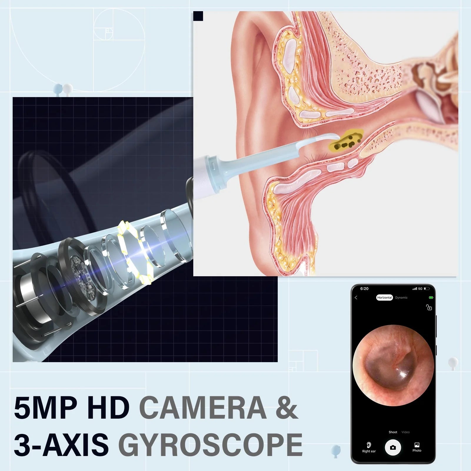 EarClear™ | Gemakkelijk oorsmeer verwijderen met realtime visuals!