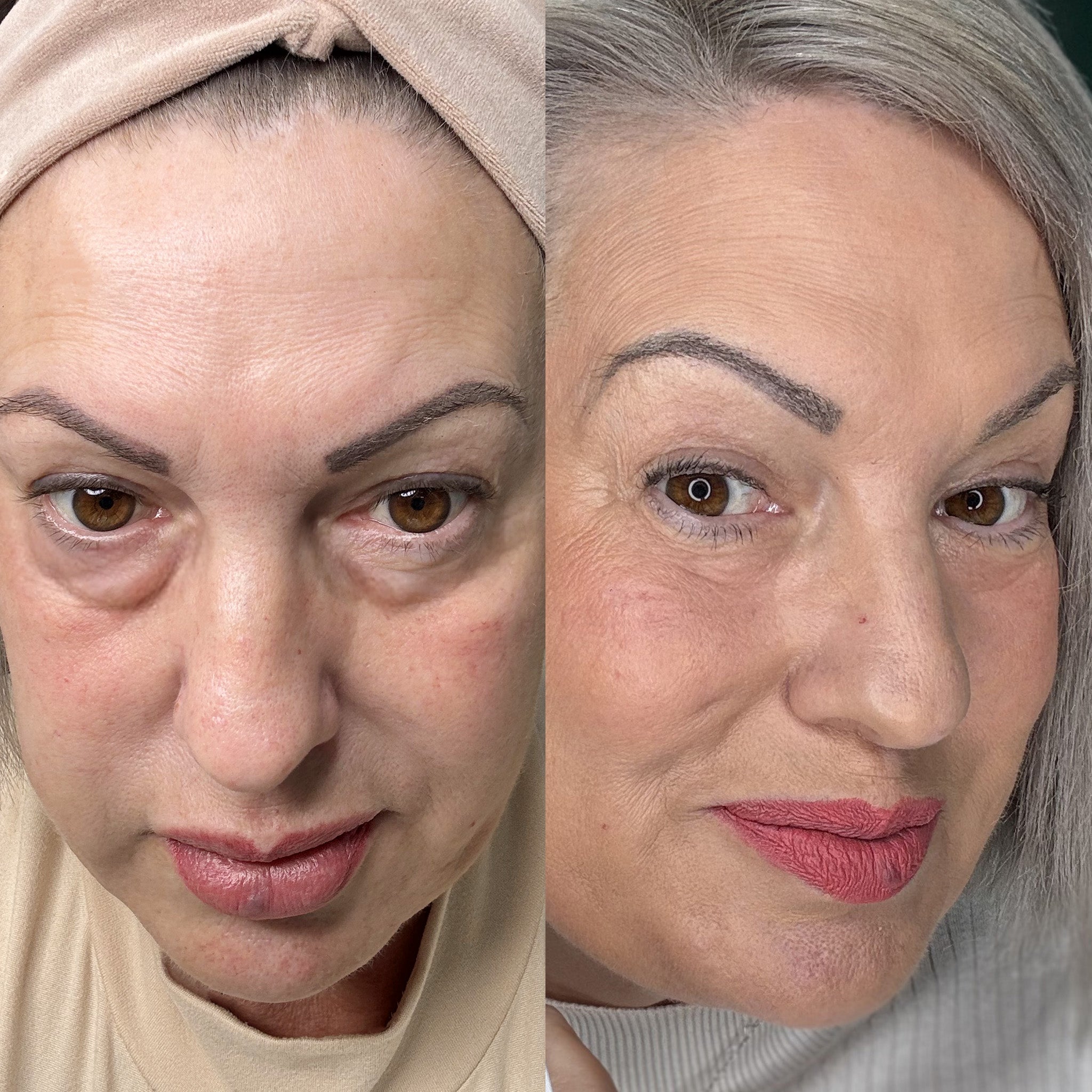 EyeRevive™ | Zeg maar dag tegen donkere kringen en wallen!