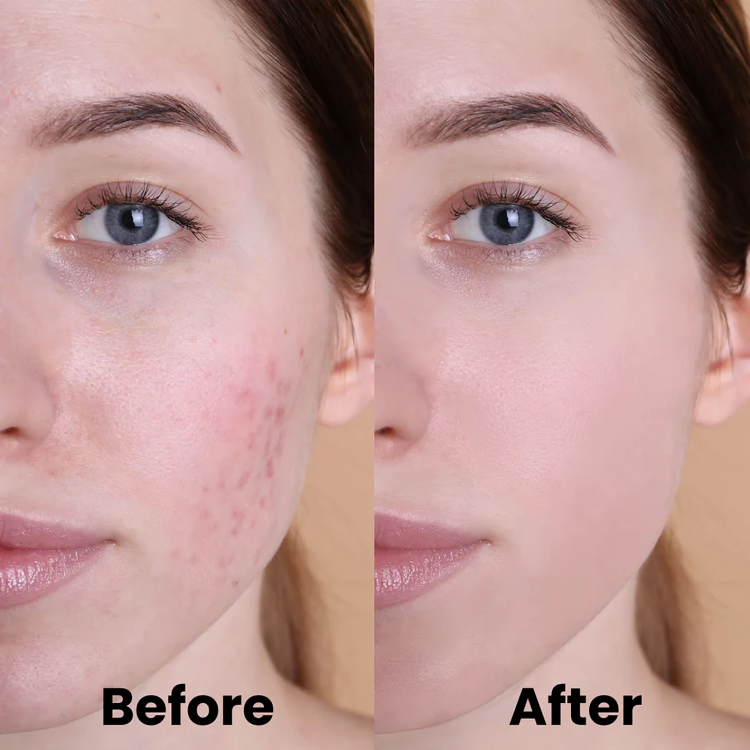 RadiancePads⢠| Kurkuma en kojinezuur pads