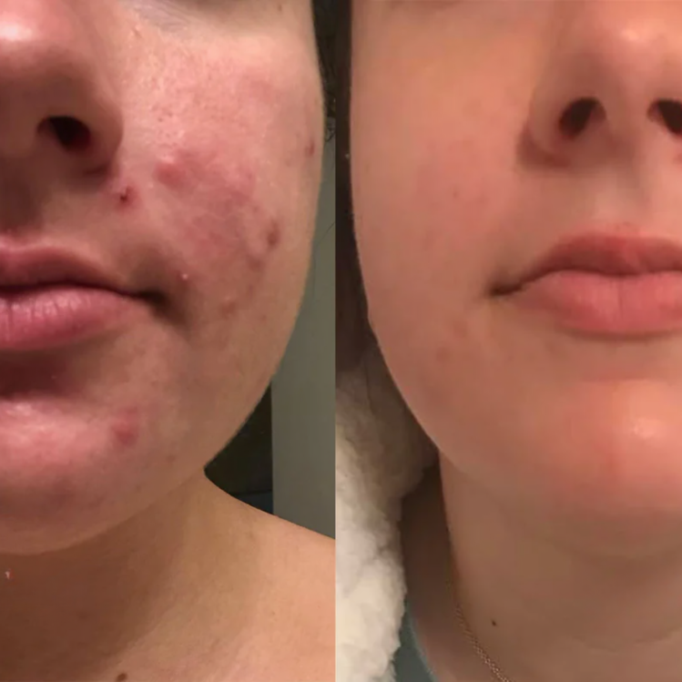 VANDAAG 1 + 1 GRATIS | SkinMend⢠| Ervaar een stralende huid!