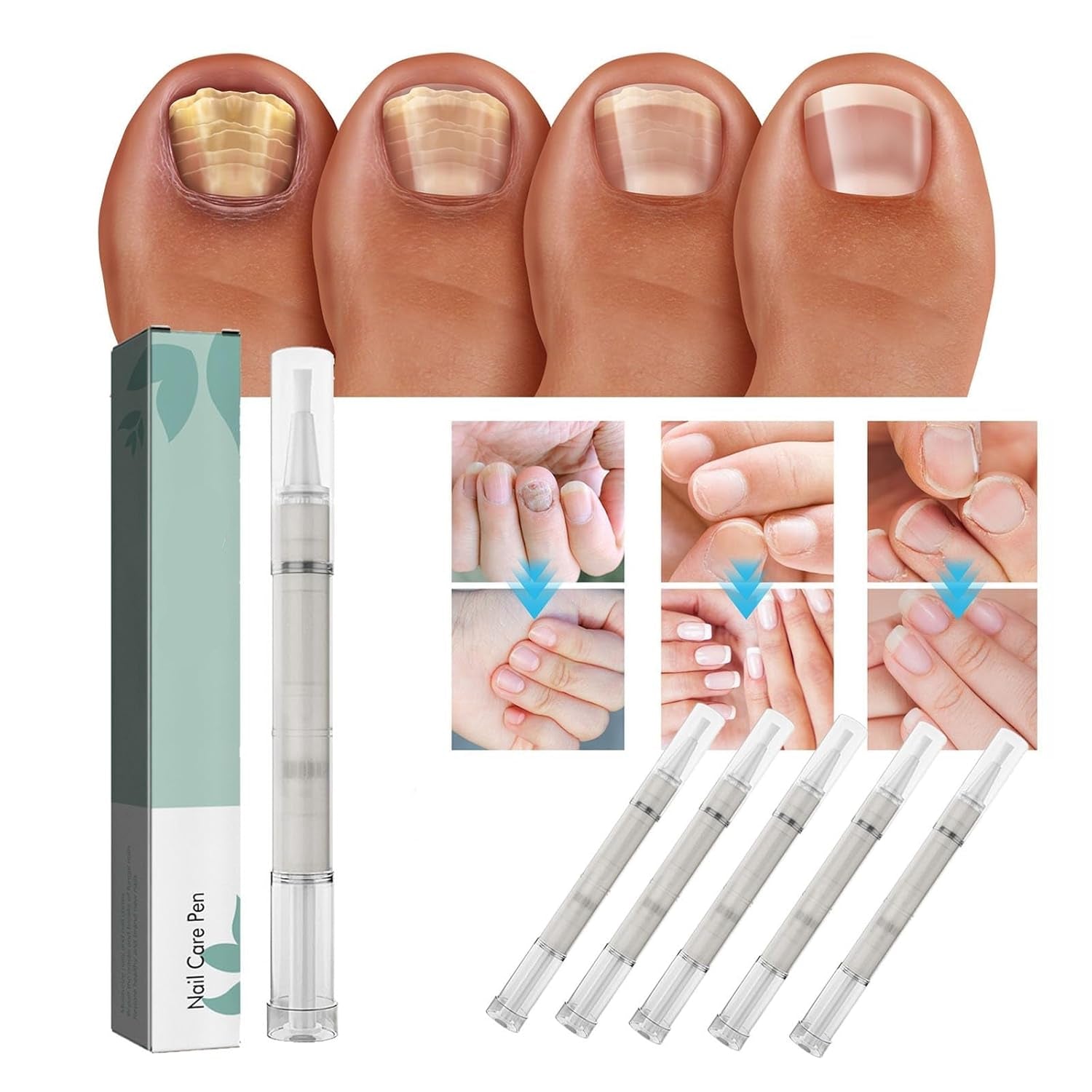 NailEssence⢠| Organische nagelverzorgingspen