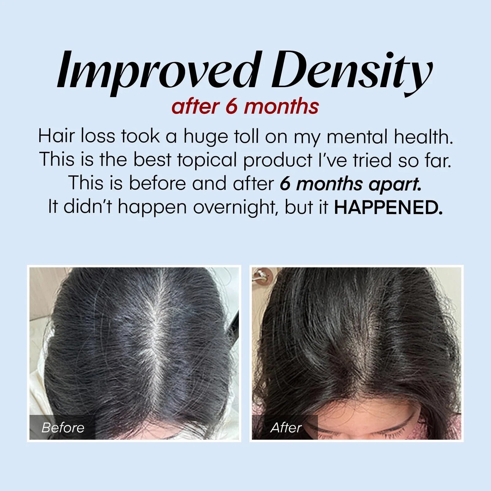 TIJDELIJK 50% KORTING | HairVive⢠| Ervaar de kracht van direct haarherstel en voeding!