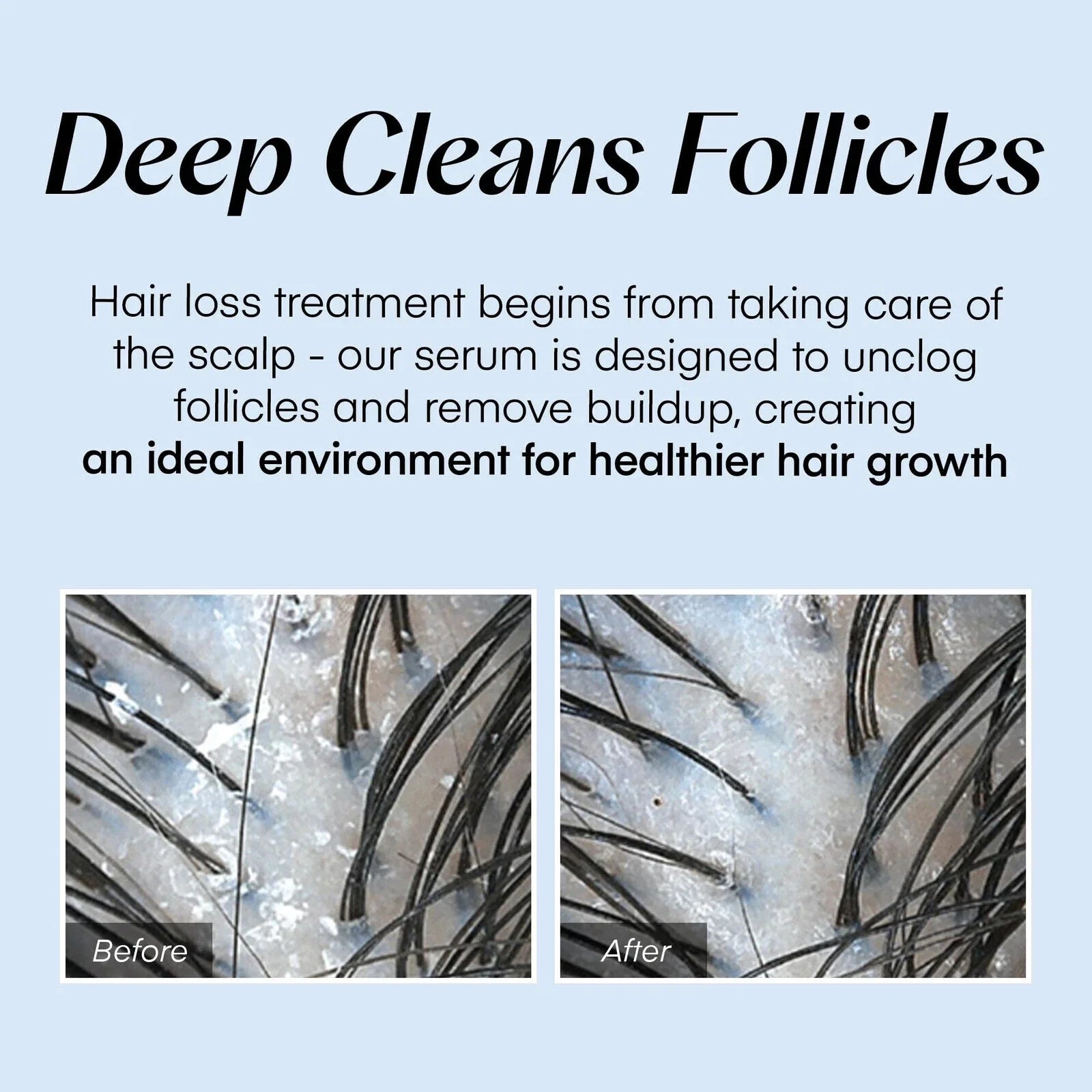 TIJDELIJK 50% KORTING | HairVive⢠| Ervaar de kracht van direct haarherstel en voeding!