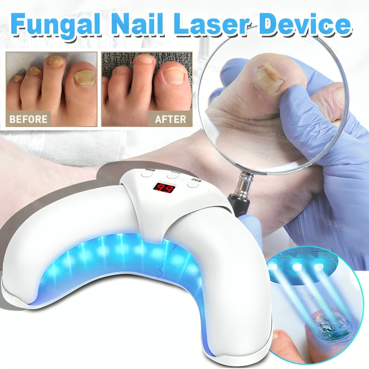 NailRenew™ | Bestrijd en elimineer schimmelnagels!