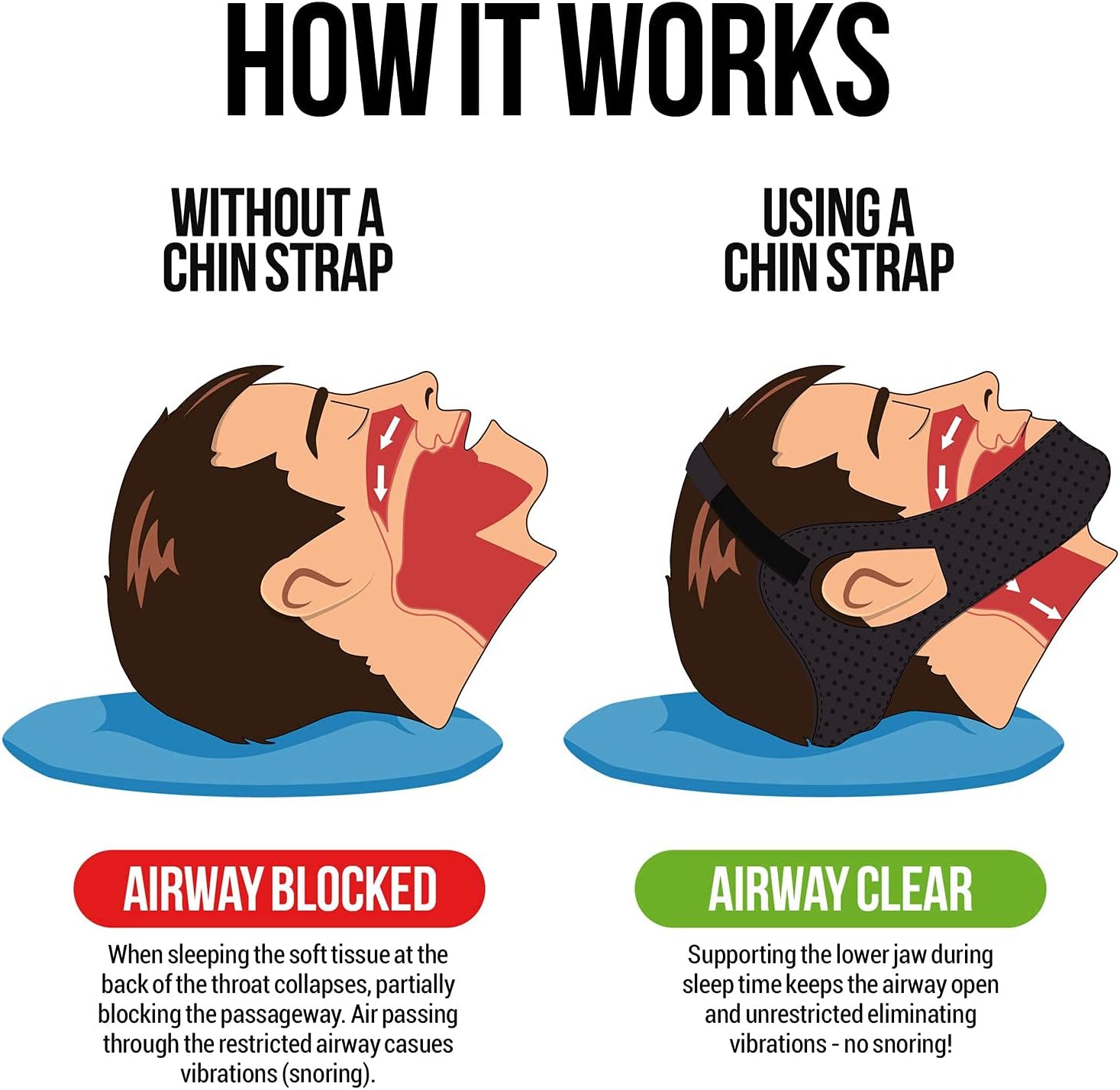 50% OFF VANDAAG | ApneaFix™ | Anti-snurk kaakriempjes