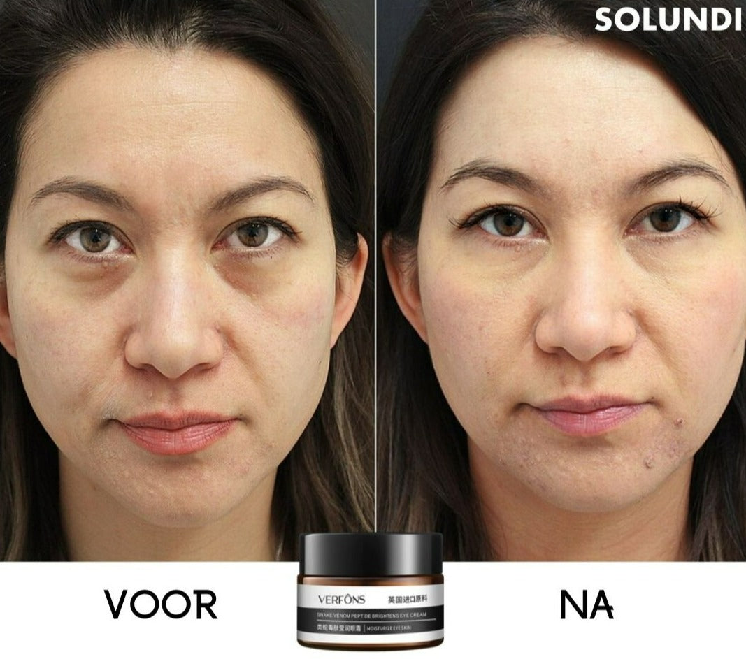 1 + 1 GRATIS VANDAAG | EyeRejuvâ˘- Verbluffende oogcrème!