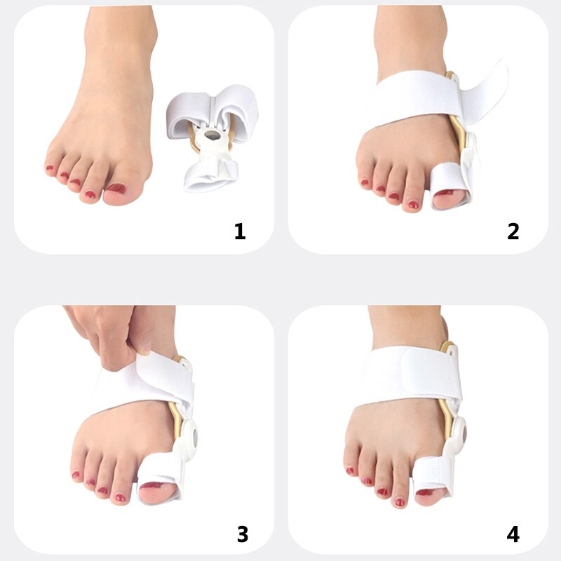 Verstelbare Teencorrector tegen Bunion – foto 5