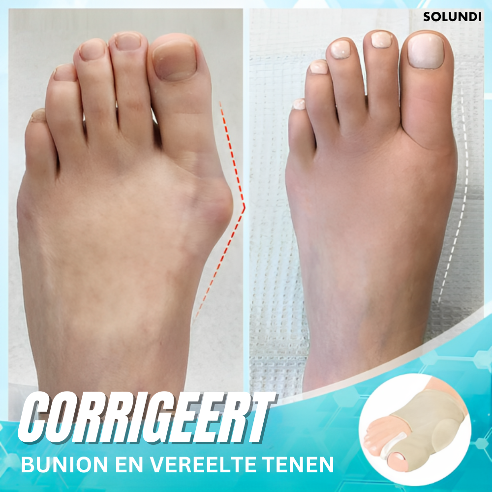 1 + 1 GRATIS VANDAAG | Dr.Fit Bunion - DĂ© Voetafwijking Correctie Sok