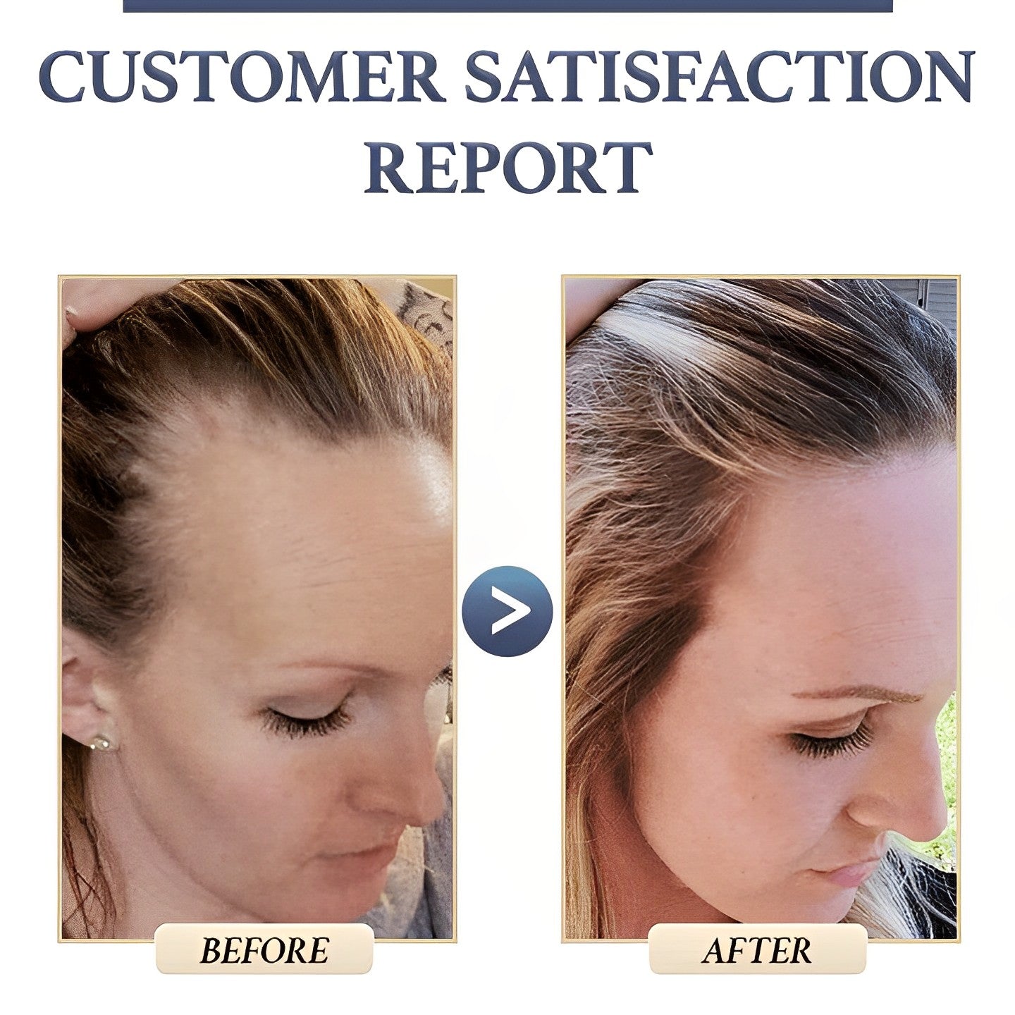 SorcerySoap™ -Anti haaruitval rijst shampoo bar